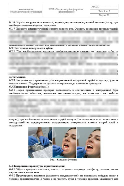 СОП «Покрытие зубов фторлаком»